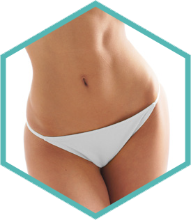 Morpheus8 skin remodelling Amsterdam - hexagon crop of the abdomen treatment area Hexagon crop of the abdomen treatment area for Morpheus8 skin remodelling in Amsterdam